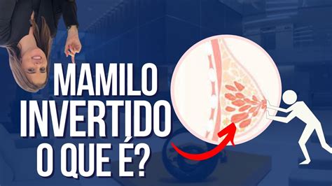 bico invertido fotos|Mamilo invertido: o que é, causas e tratamento